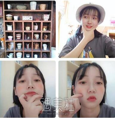 北京,李沁奕,隆鼻