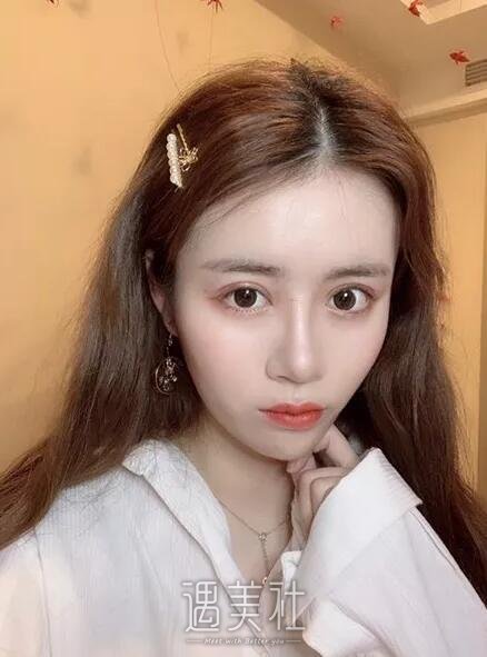 黄石中爱整形医院做双眼皮怎么样?有真实的案例吗?