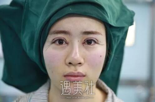 黄石中爱整形医院做双眼皮怎么样?有真实的案例吗?