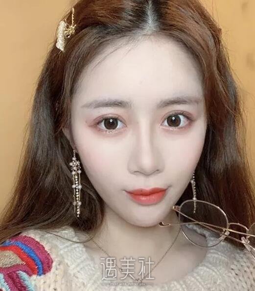 黄石中爱整形医院做双眼皮怎么样?有真实的案例吗?