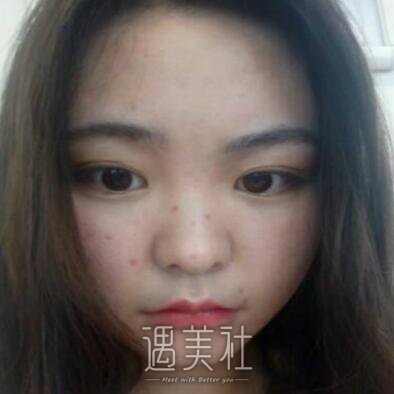 广州军区总医院整形科去痣果好吗?有真实案例吗?
