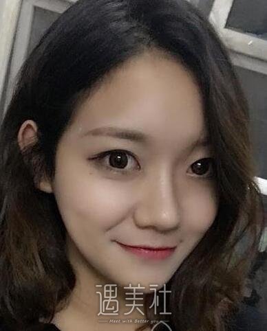 重庆永川蝶姿医院除皱技术如何?有相关的案例吗?