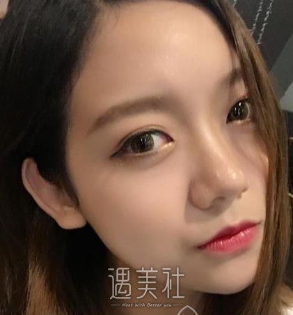 重庆永川蝶姿医院除皱技术如何?有相关的案例吗?