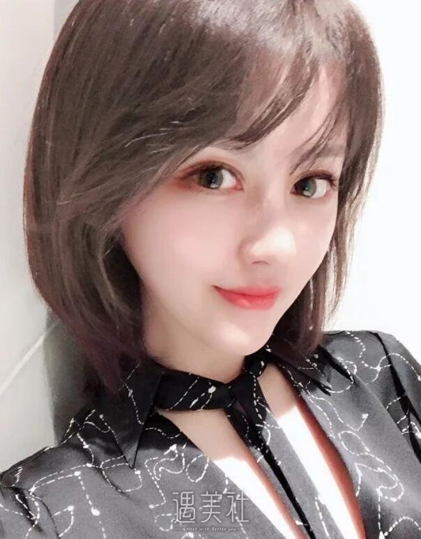 玉溪左医生脂肪填充技术好吗?能让我面部丰盈起来吗?