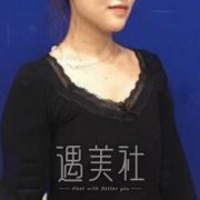刘成胜丰胸真实案例分享，30天的恢复日记~ width=