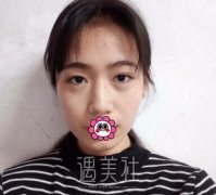 华西卿勇去眼袋怎么样？有案例吗？ width=