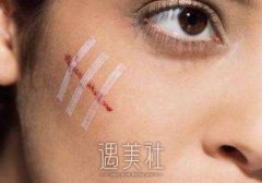 上海九院除疤价格是多少？是不是很贵？ width=