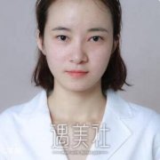 刘菲双眼皮案例：眼睛大了自信多了~ width=
