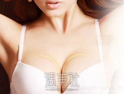 无锡,微创丰胸