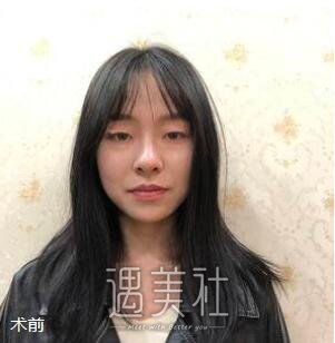 杭州,艺星,王光建