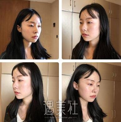杭州,艺星,王光建