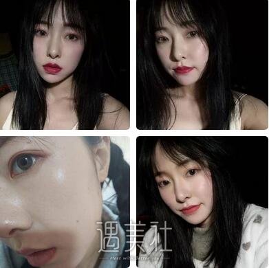 杭州,艺星,王光建