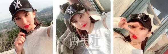 武汉,美基元,项利娇,割双眼皮