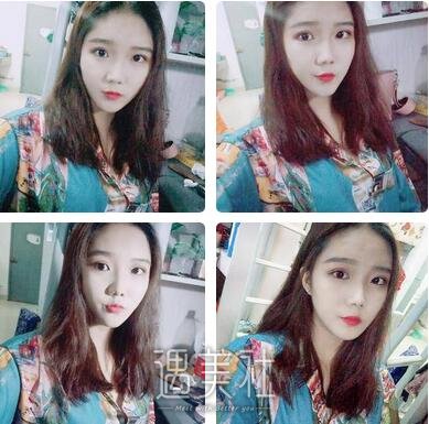 南京,美贝尔,黄名斗,隆鼻