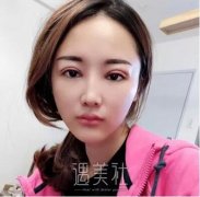 江苏省中医院整形双眼皮怎么样?有相关案例吗? width=
