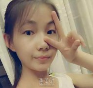 沧州京美做双眼皮好吗?做完整个人气质都变了! width=