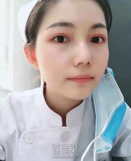 沧州京美做双眼皮好吗?做完整个人气质都变了!