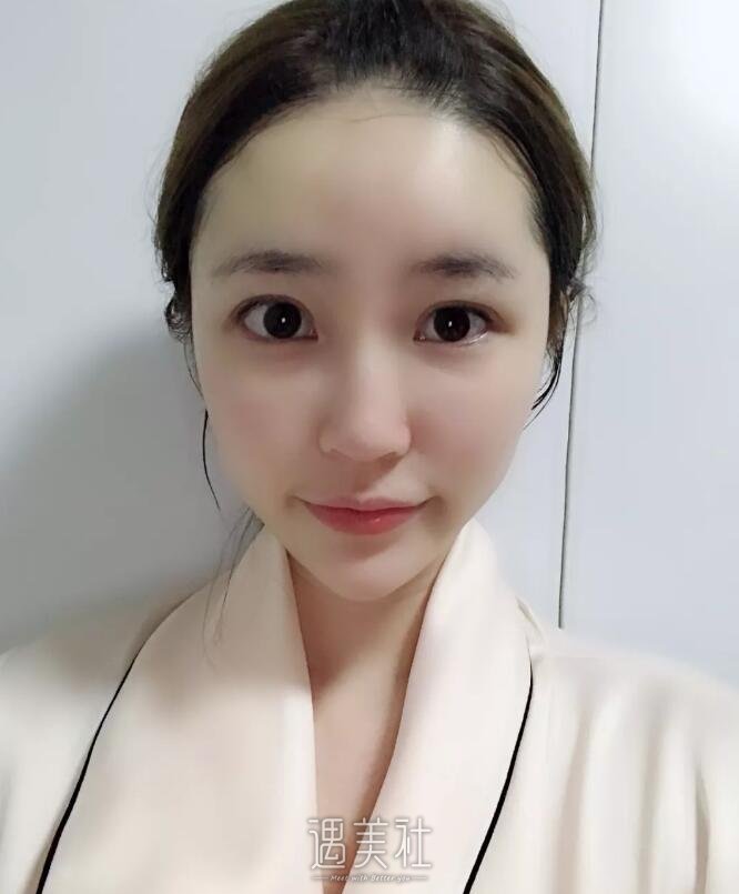 北京东方和谐面部脂肪填充技术如何?有真实案例吗?
