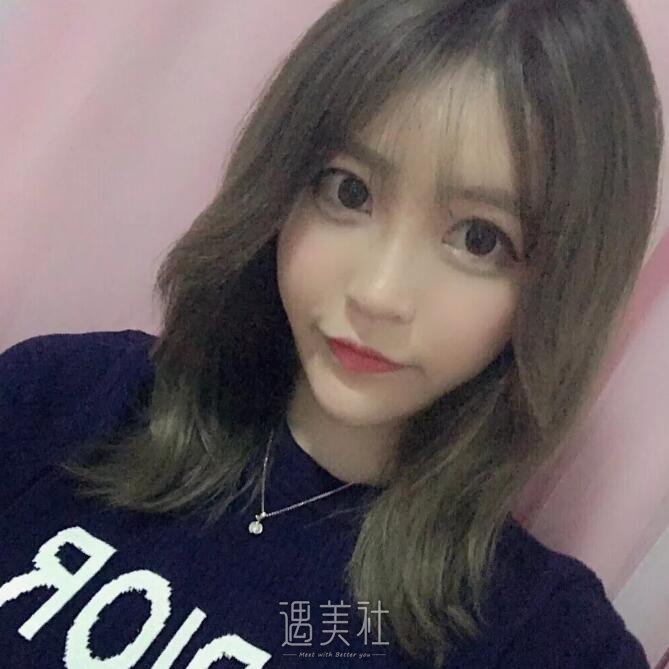 北京东方和谐面部脂肪填充技术如何?有真实案例吗?