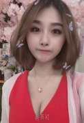 北京东方和谐自体脂肪丰胸案例展示|冯斌技术真好! width=