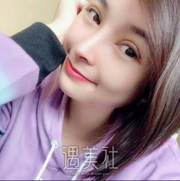 华西,李正勇,隆鼻
