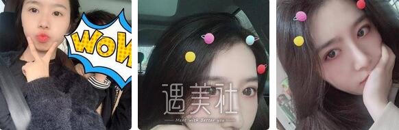 李长赋做鼻子怎么样？案例？ width=
