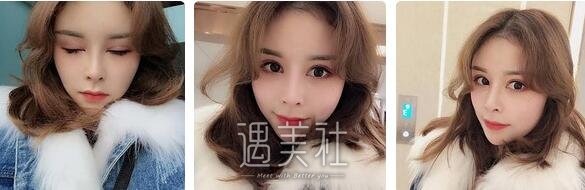 军美,章小平,隆鼻
