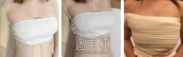 万连壮,假体隆胸