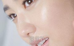 吉大二院光子嫩肤价格多少？ width=