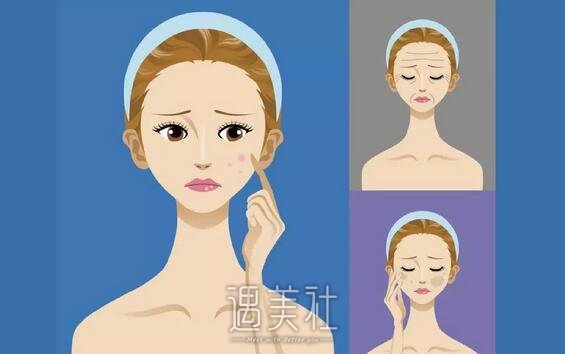 北京，清华长庚，光子嫩肤