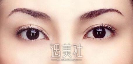 西美