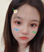 济南海峡双眼皮靠谱吗?有没有真实的双眼皮案例? width=