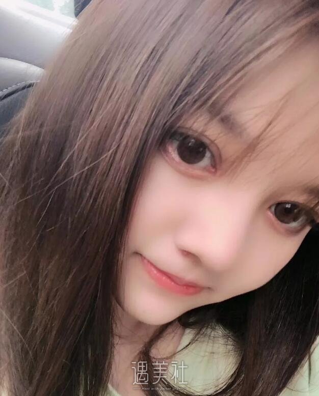 济南海峡双眼皮靠谱吗?有没有真实的双眼皮案例?