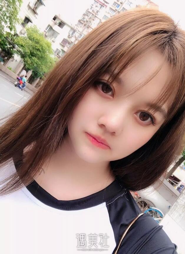济南海峡双眼皮靠谱吗?有没有真实的双眼皮案例?