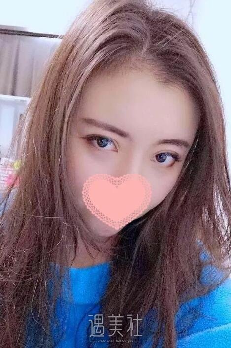 济南海峡医院植发怎么样?我想拥有正常的发际线!