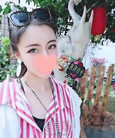济南海峡医院植发怎么样?我想拥有正常的发际线!