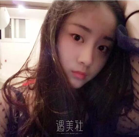 成都艾尚柏雅做双眼皮怎么样?能变得人见人爱吗?