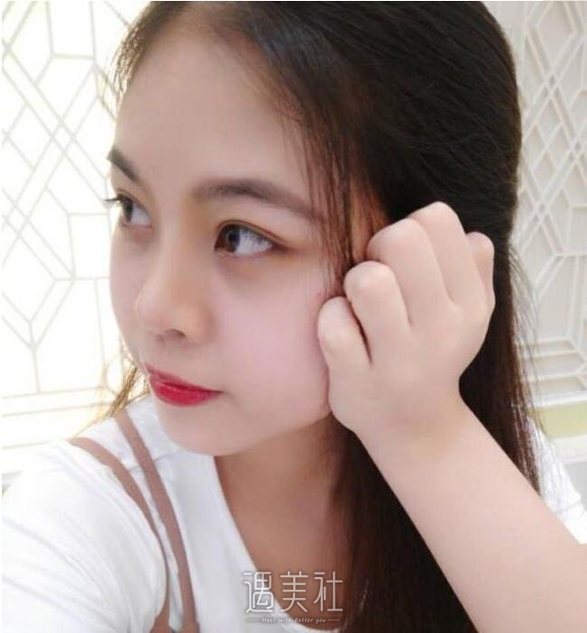 恩施华美整形医院做隆鼻技术如何?有真实案例吗?