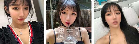 李发成,自体脂肪丰胸