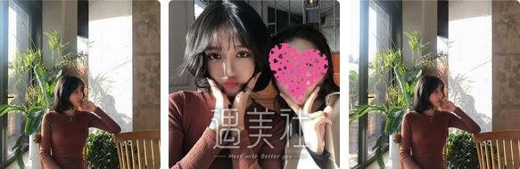 李发成,自体脂肪丰胸