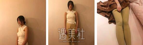 李发成,自体脂肪丰胸
