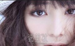 南方医院割双眼皮价格大概多少？ width=