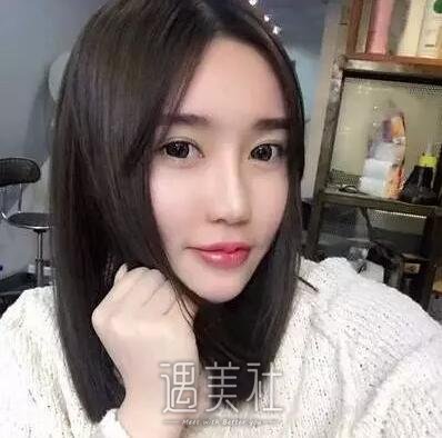 八大处刘墩鼻部手术案例|根本没人鼻子是做的!