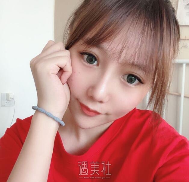 北京八大处鼻部手术案例展示|这还是我吗?