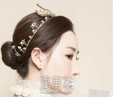 贝拉陈松涛鼻部手术案例|气质完全不一样了!