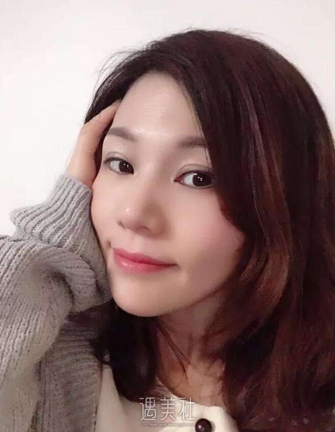 李战强鼻修复案例展示|看了我也想做!
