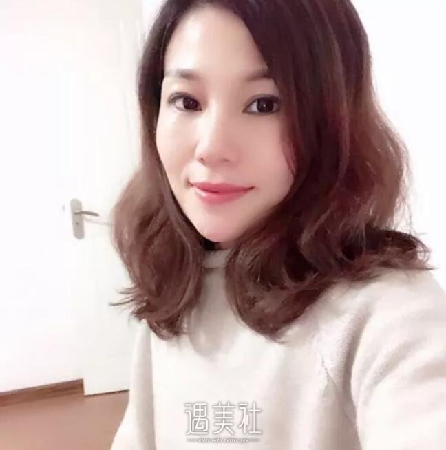 李战强鼻修复案例展示|看了我也想做!