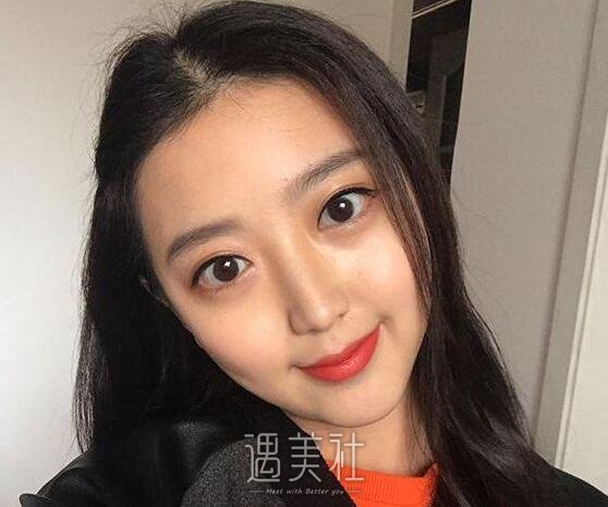 南宁东方整形垫下巴案例|整个脸型都变了!
