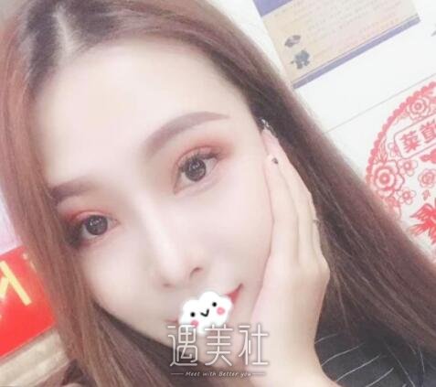 贾德渊,隆鼻