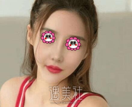 南京,李俊,隆鼻